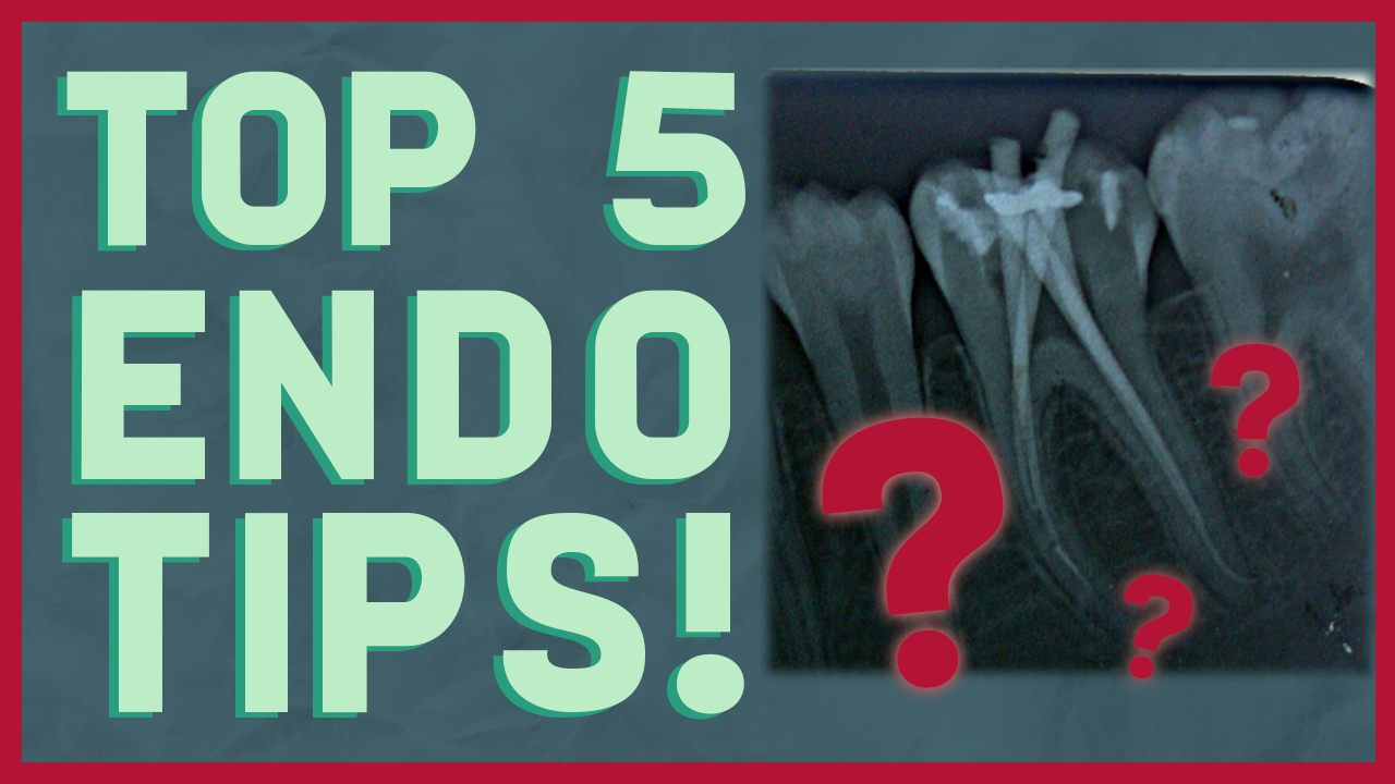 Root Canal Treatment - Top 5 Tips!